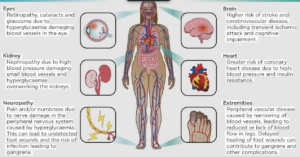 Complications of Diabetes and How to Manage