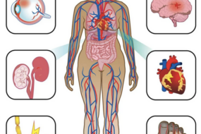 Complications of Diabetes and How to Manage Them