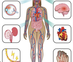 Complications of Diabetes and How to Manage Them