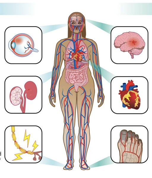 Complications of Diabetes and How to Manage Them