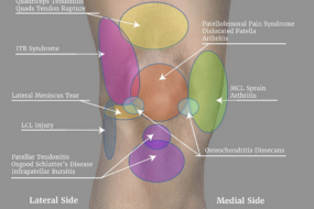 Diagnosing Joint Pain