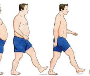 Genetics and weight loss