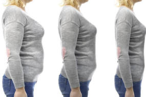 Long-term Maintenance of Weight Loss