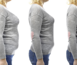 Long-term Maintenance of Weight Loss