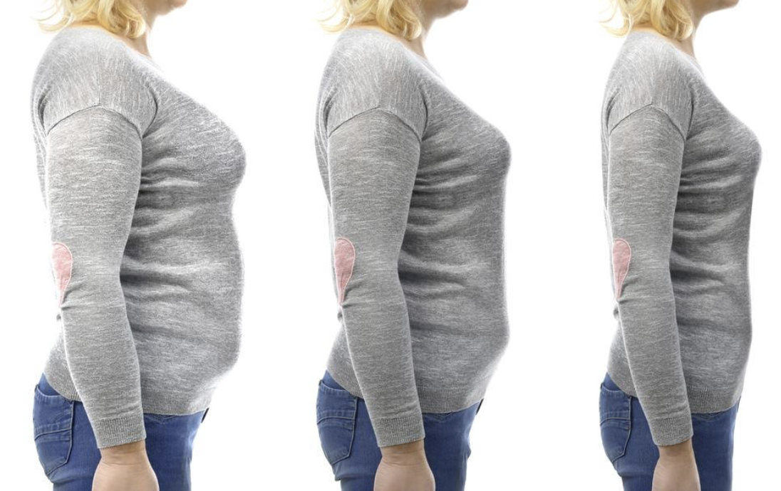 Long-term Maintenance of Weight Loss