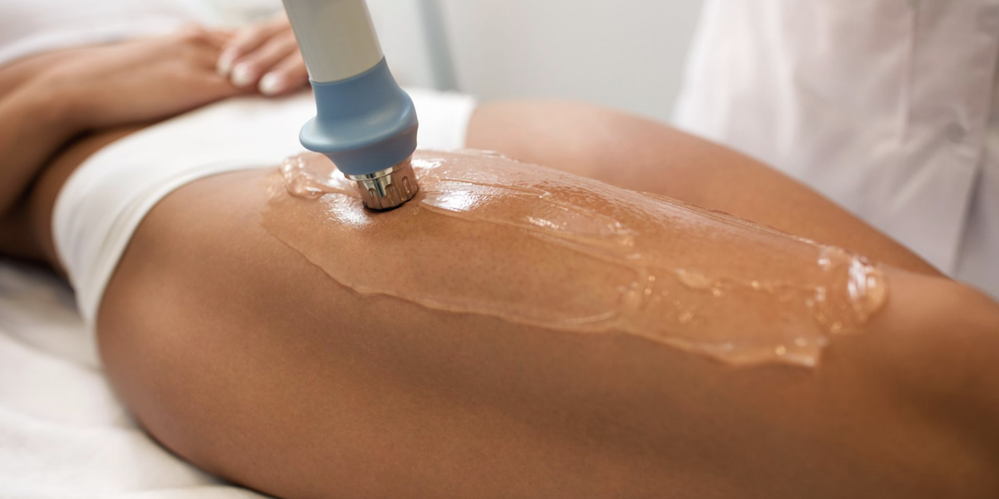 Non-Surgical Procedures for Cellulite