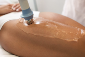 Non-Surgical Procedures for Cellulite