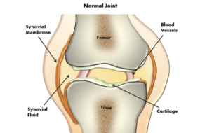 Reduce inflammation in joints