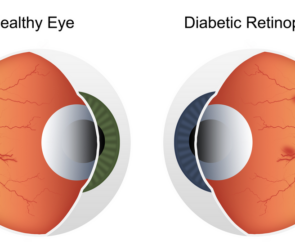 eye care and diabetes