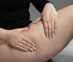 how to get rid of cellulite