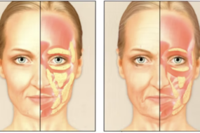 how to lose weight in face