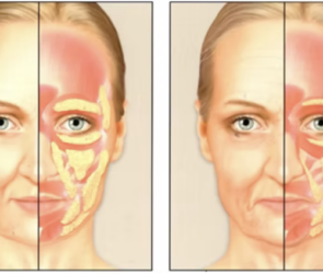 how to lose weight in face