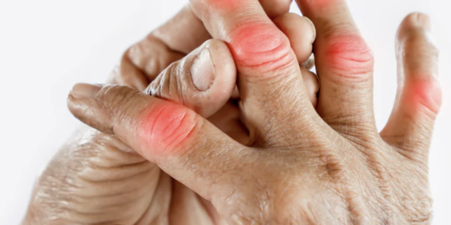 multiple joint pain without swelling menopause
