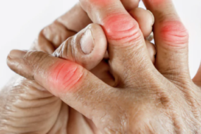 multiple joint pain without swelling menopause