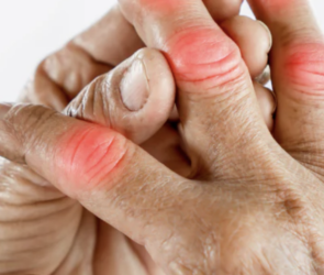 multiple joint pain without swelling menopause